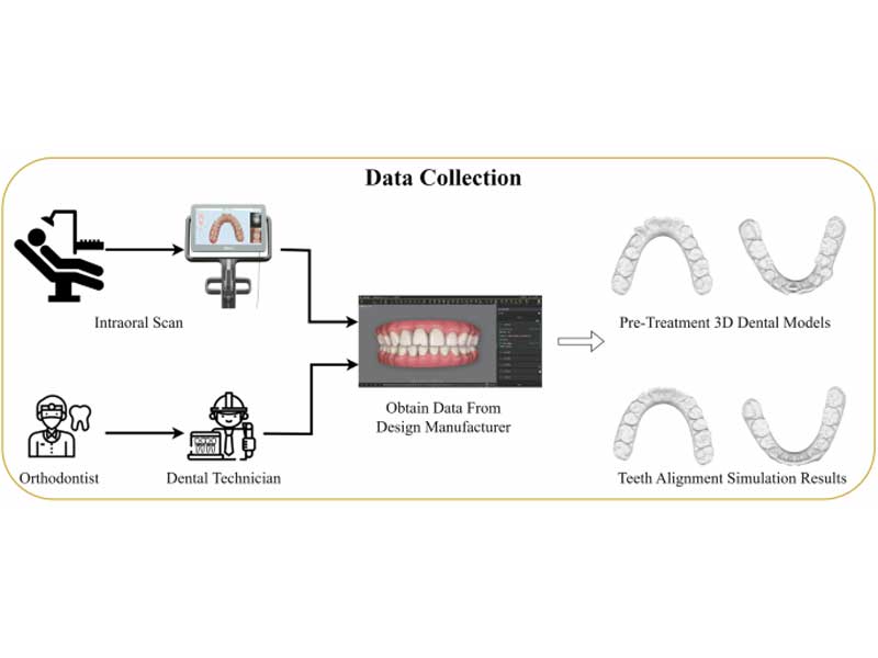 اقدامات قبل از ارتودنسی