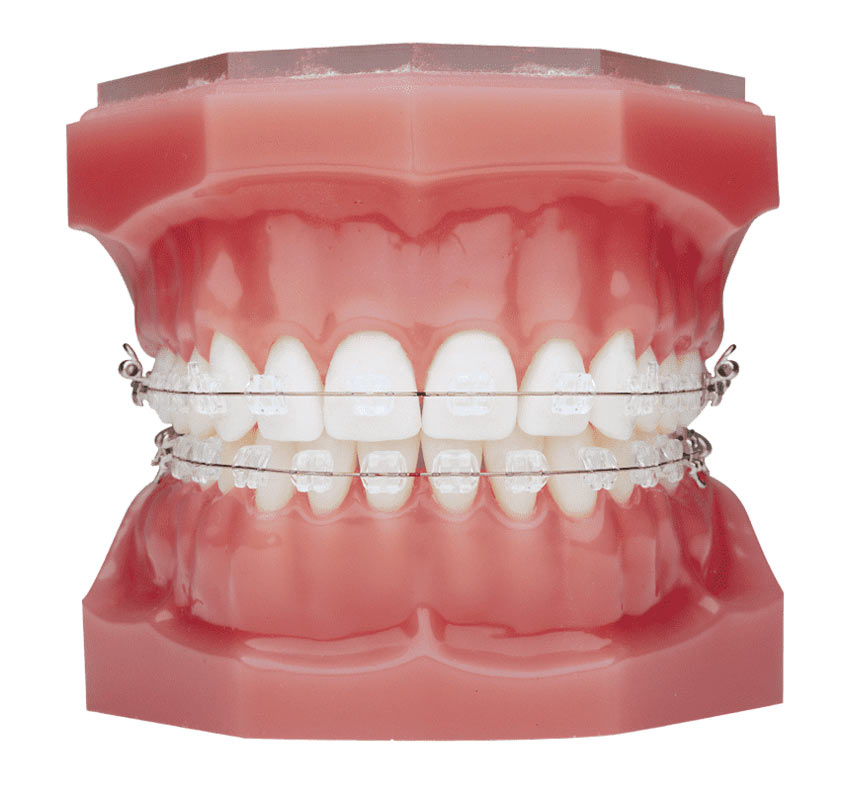 ارتودنسی دیمون در تهران