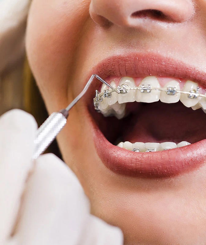 متخصص ارتودنسی دیمون