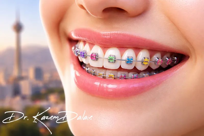 مشاوره ارتودنسی تهران