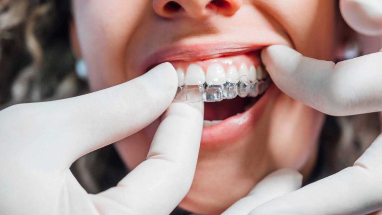 الاینر ارتودنسی