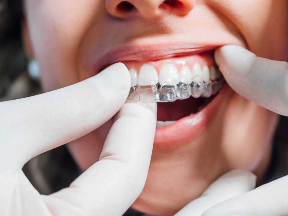 الاینر ارتودنسی