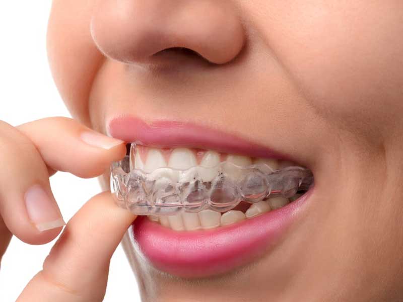 الاینر ارتودنسی