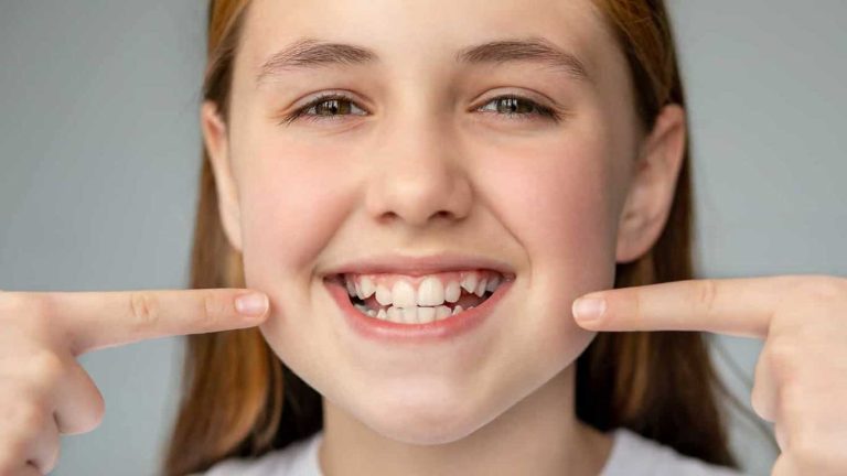 شلوغی دندان‌ ها