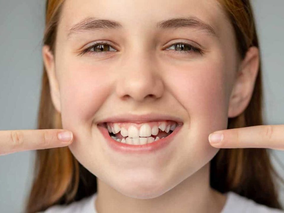 شلوغی دندان‌ ها