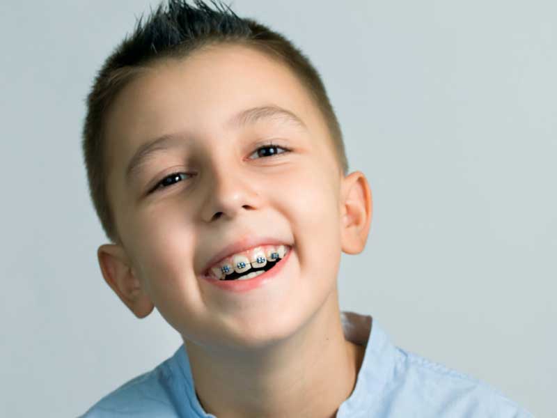 ارتودنسی دندان های شیری