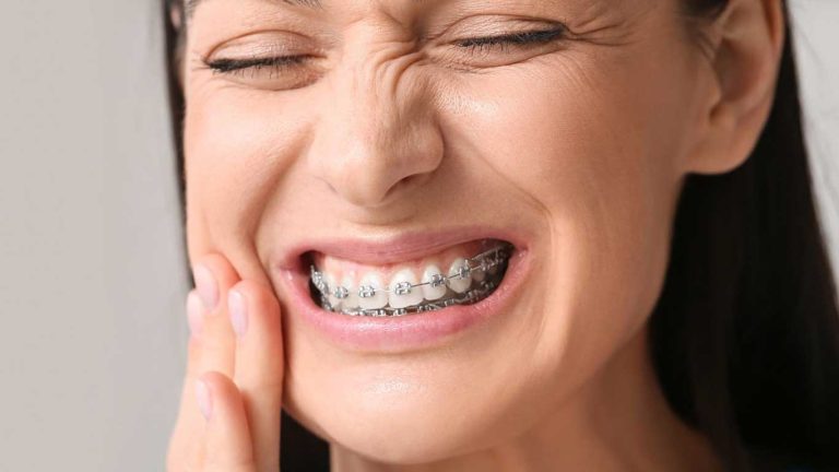 درد ارتودنسی