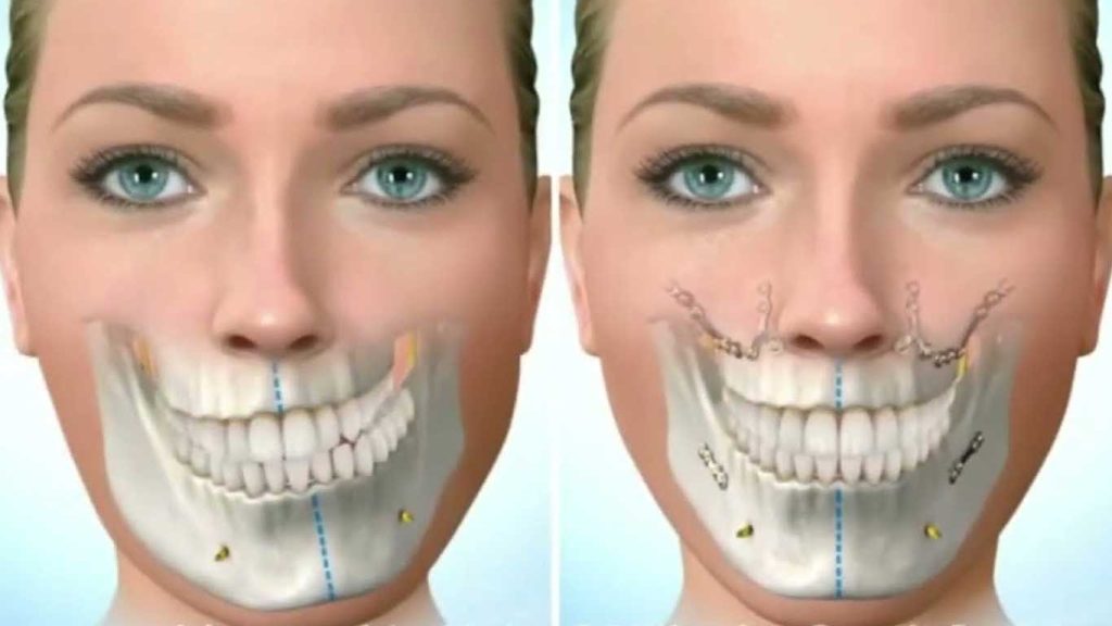 فک نامتقارن