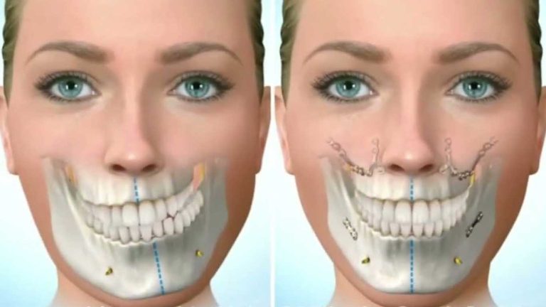 فک نامتقارن