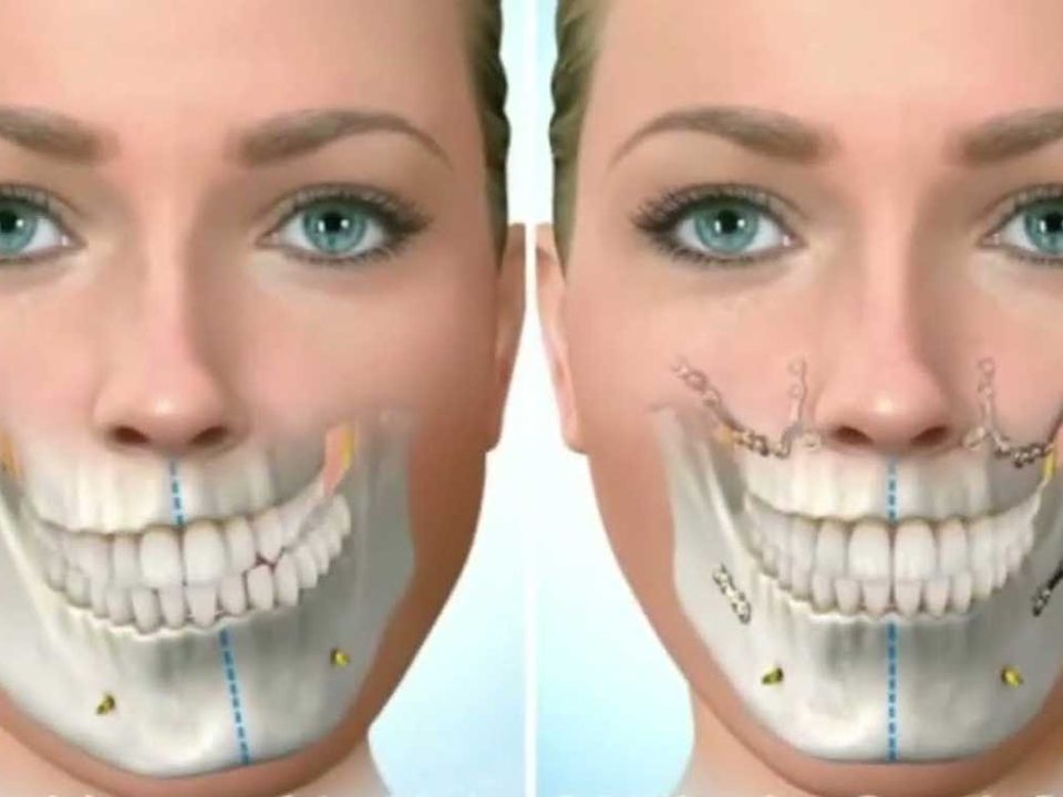 فک نامتقارن