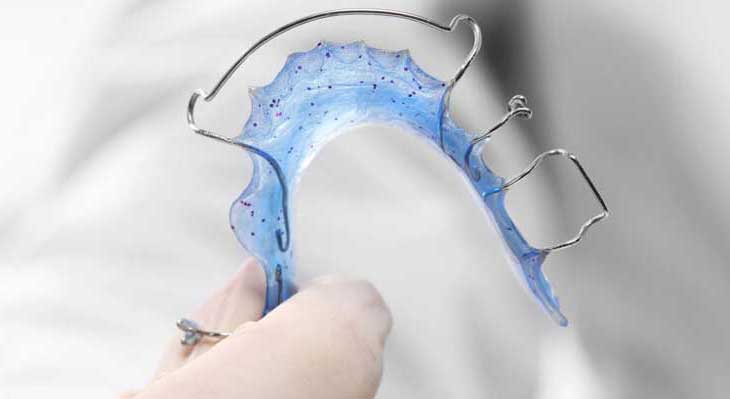 پلاک ارتودنسی