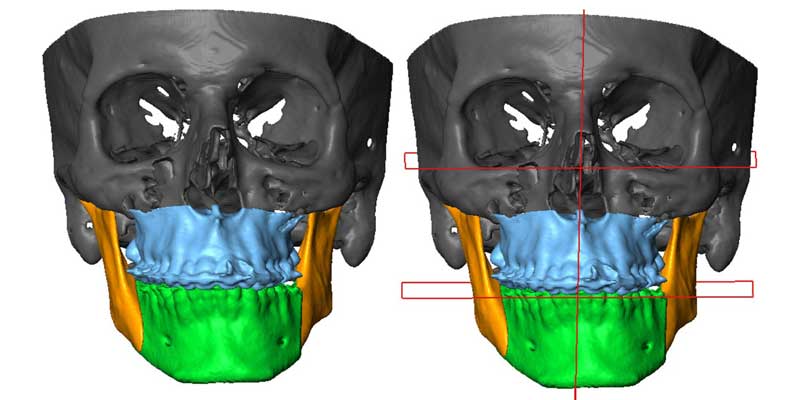 فک نامتقارن