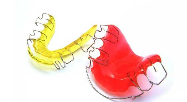 پلاک ارتودنسی