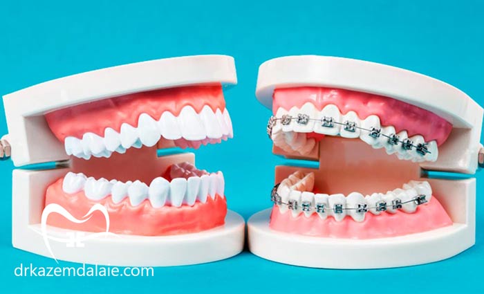 بهترین متخصص ارتودنسی در پاسداران