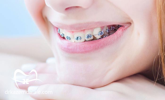 متخصص ارتودنسی در پاسداران