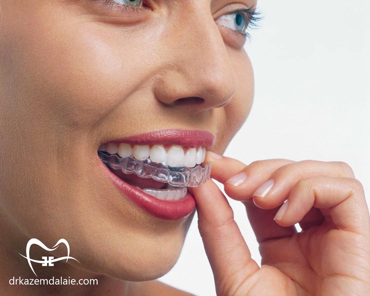 بهترین دکتر ارتودنسی نامرئی در تهران