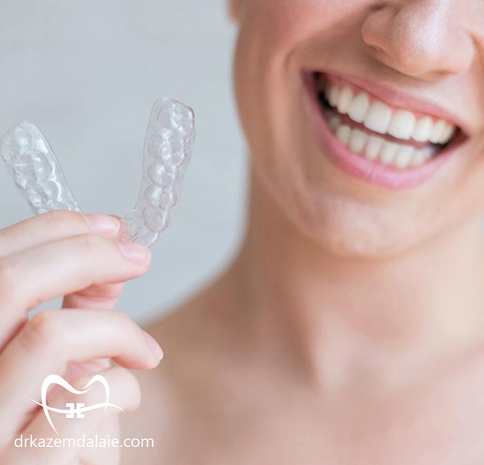 هزینه ارتودنسی نامرئی در تهران