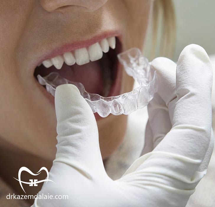 بهترین متخصص ارتودنسی نامرئی در تهران