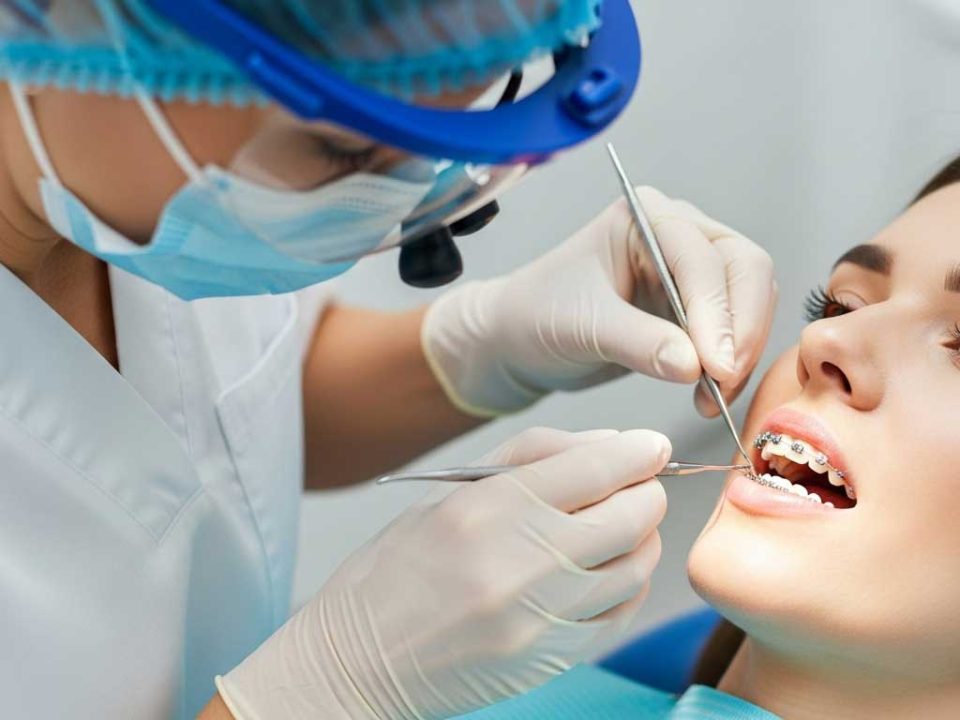 صاف کردن دندان کج