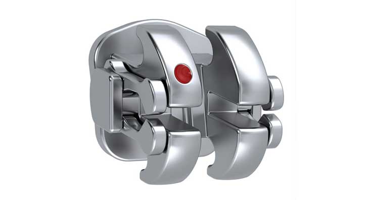 تفاوت ارتودنسی دیمون و ثابت