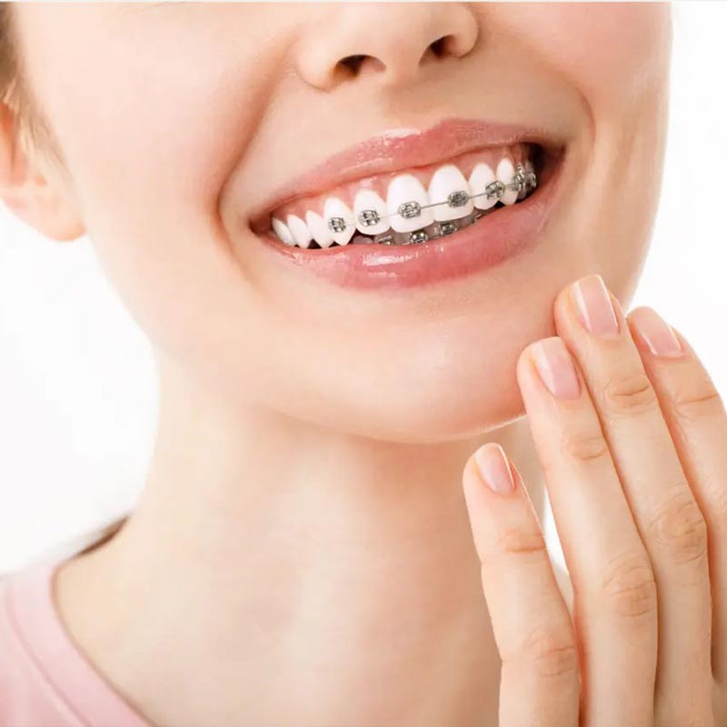 متخصص ارتودنسی کودکان تهران