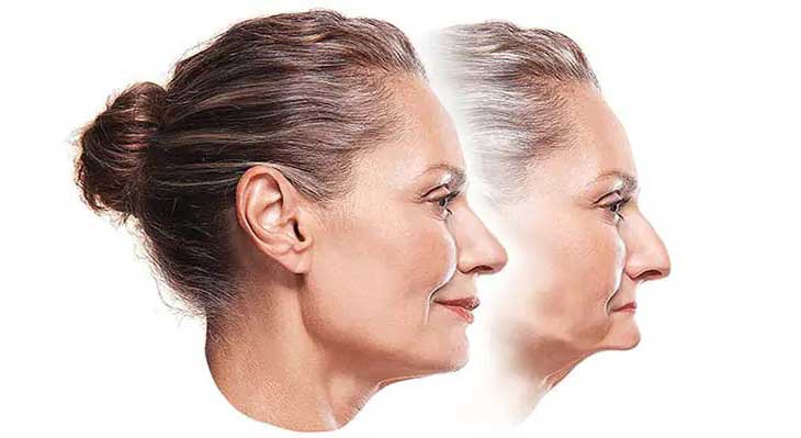 تحلیل استخوان فک