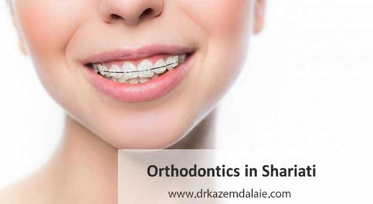 متخصص ارتودنسی در خیابان شریعتی