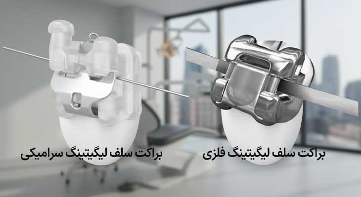 براکت سلف لیگیتینگ