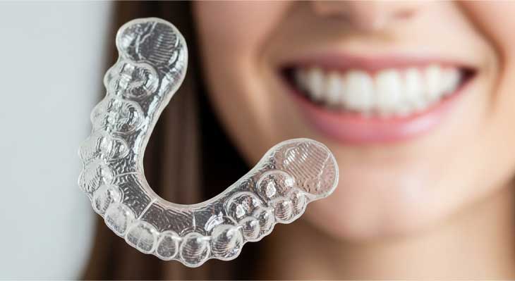 پلاک متحرک بعد از ارتودنسی