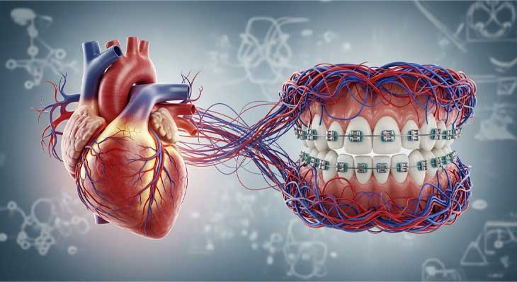ارتودنسی و بیماری های قلبی